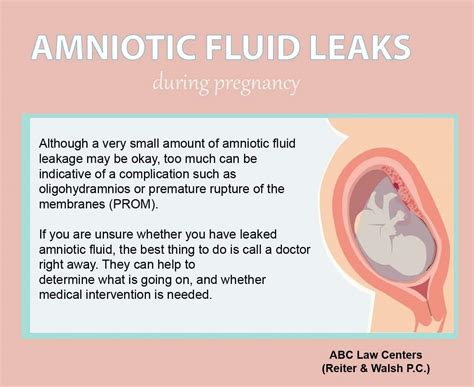 amniotic.fluid leaking|Leaking Amniotic Fluid 